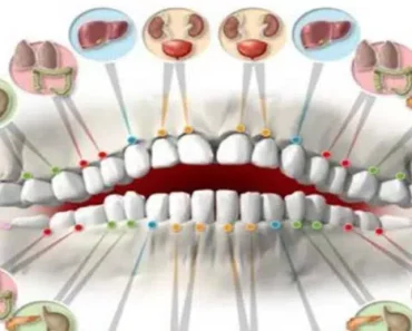 Each Tooth Is Associated With Certain Organ in the Body – Pain in Each Of Them Can Predict Problems