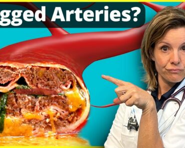 4 Silent Signs You May Have Clogged Arteries and the Best Foods to eat to prevent it