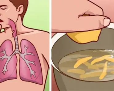 9 Home Remedies to Help With Bronchitis and Painful Coughing Attacks