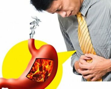 Naturally Treat Acid Reflux and GERD with these Helpful Tips