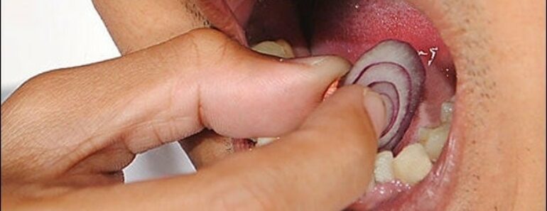 Natural Remedies for Toothache that Actually Work