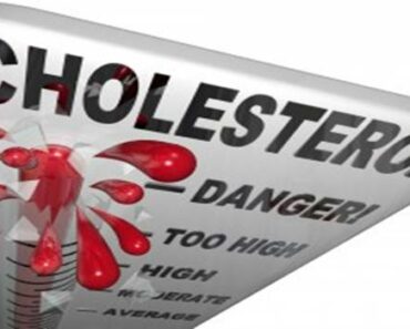 What You Should Know About Cholesterol