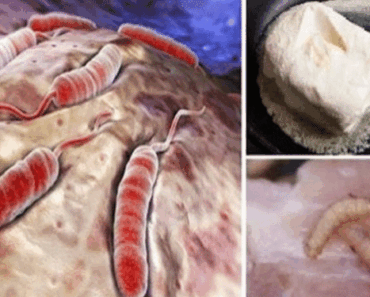 Oncologists Urge You to Stop Eating These Foods That Are Proven to Cause Cancer