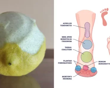 Lemon Peel Trick To Get Rid Of Inflammation And Chronic Pain