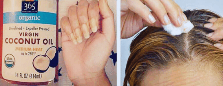 15 Coconut Oil Uses for Personal Hygiene You Must Try