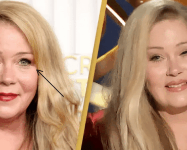 Christina Applegate Reveals 5 Very Unusual Symptoms She Overlooked Before Her MS Diagnosis – Here’s What to Watch For