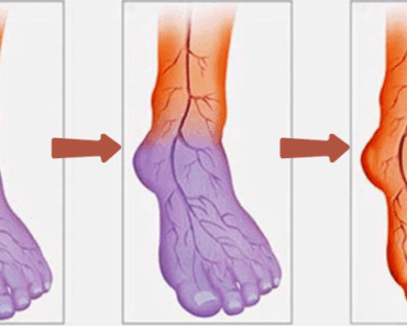 Poor Blood Circulation, Cold Legs, and Hands? Expert Therapist Reveals 3 Remedies and Tips to Solve This Problem