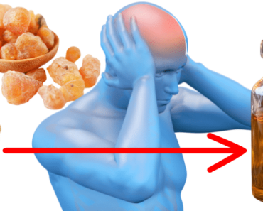 The Oil That’s Gaining Popularity for Treating Migraines, Anxiety, even Depression