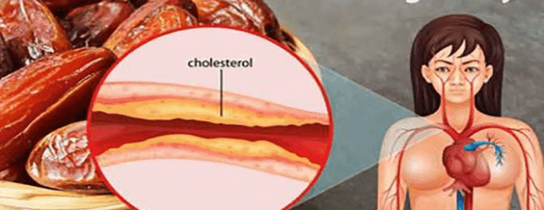 Is This the World’s #1 Food for Beating Strokes, High Blood Pressure, and Cholesterol?