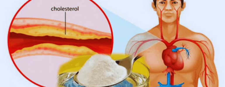Top 5 Home Medicine Against Cholesterol and High Blood Pressure